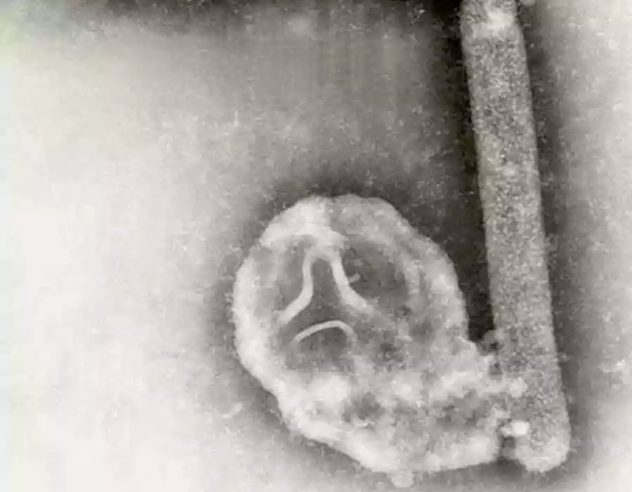 అమెరికాను వణికిస్తున్న సరికొత్త వైరస్‌..